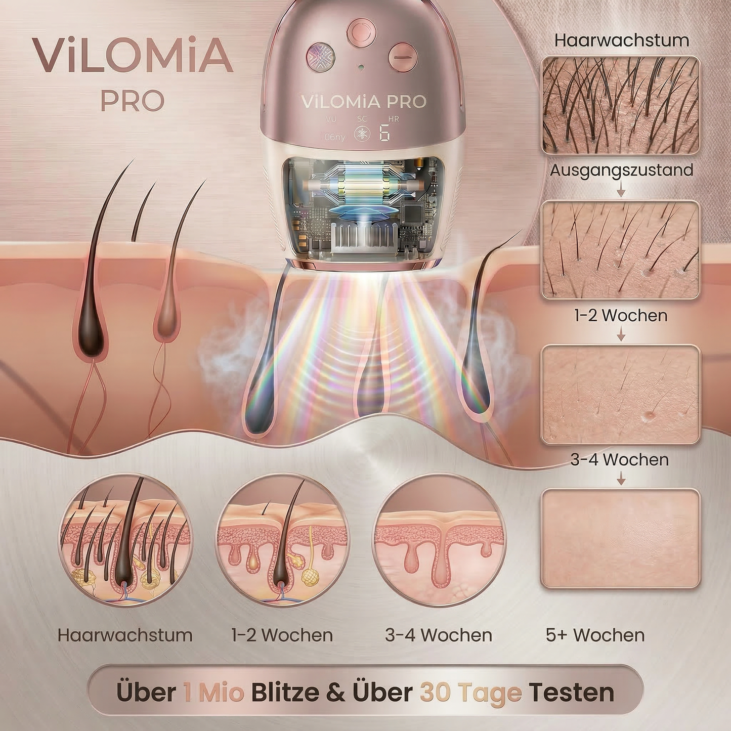VILOMIA IPL 2.0