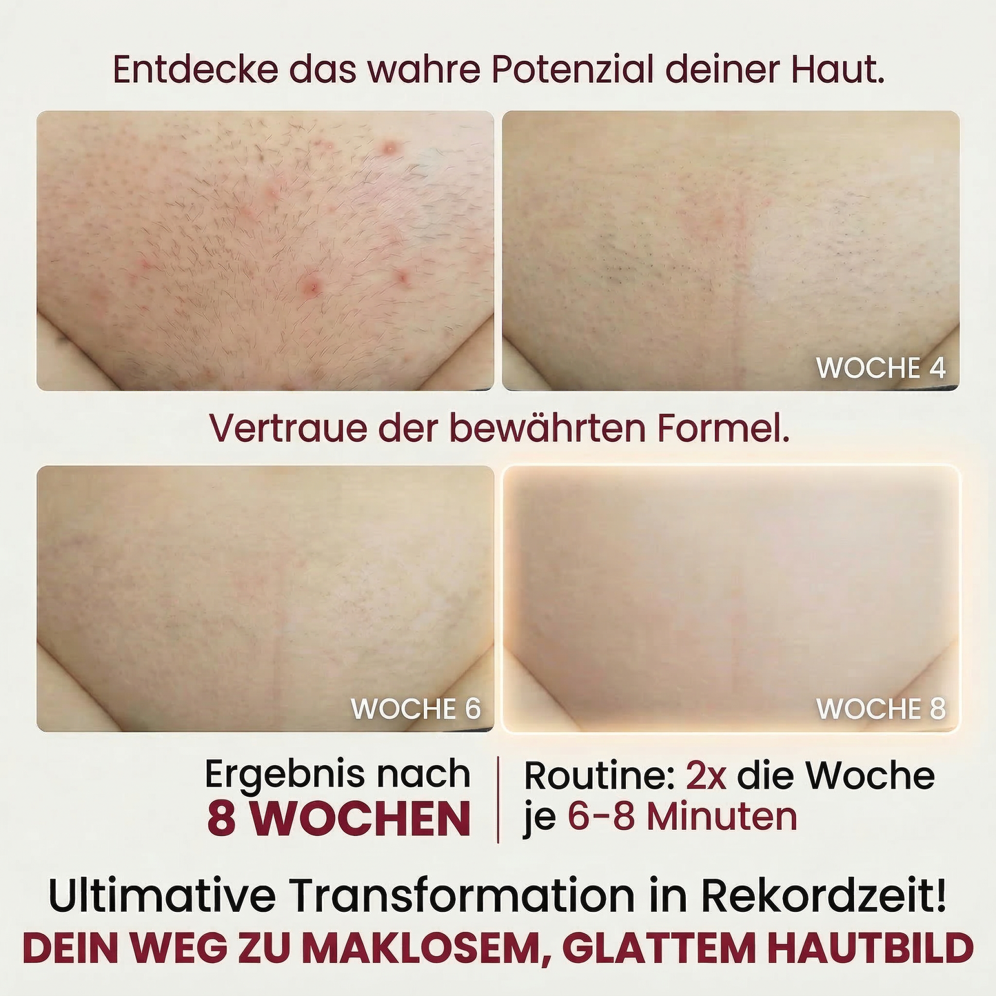 VILOMIA IPL 2.0